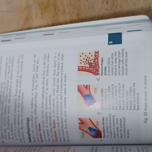 Lewis's Medical-Surgical Nursing Clinical Companion 11th Edition - Picture 2 of 4